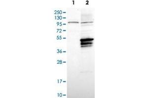Western Blot analysis of Lane 1: negative control (vector only transfected HEK293T cell lysate) and Lane 2: over-expression lysate (co-expressed with a C-terminal myc-DDK tag in mammalian HEK293T cells) with USP2 polyclonal antibody . (USP2 Antikörper)