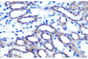 Immunohistochemistry of paraffin-embedded Mouse kidney using TSG101 Polyclonal Antibody at dilution of 1:100 (40x lens). (TSG101 Antikörper)