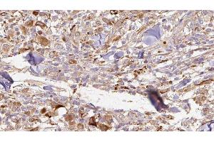 Immunohistochemistry (IHC) image for anti-Interleukin 1 Receptor Antagonist (IL1RN) (Internal Region) antibody (ABIN6262550)