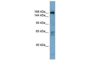 Western Blot showing DOCK2 antibody used at a concentration of 1-2 ug/ml to detect its target protein. (DOCK2 Antikörper  (Middle Region))