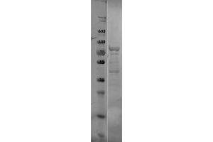 SDS-PAGE of p39 Control Protein. (p39 Protein)