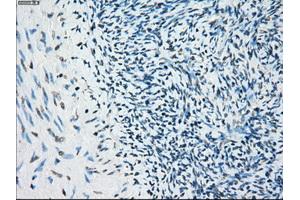 Immunohistochemical staining of paraffin-embedded colon tissue using anti-BUB1Bmouse monoclonal antibody. (BUB1B Antikörper)