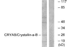 Western blot analysis of extracts from K562 cells, treated with Ca2+ (40nM, 30mins), using CRYAB/Crystallin-α-B (Ab-59) antibody. (CRYAB Antikörper)