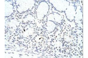 Image no. 1 for anti-Zinc Finger Protein 580 (ZNF580) (AA 31-80) antibody (ABIN6736331) (ZNF580 Antikörper  (AA 31-80))