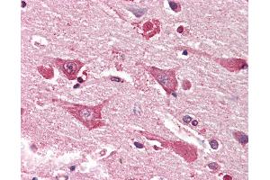 Anti-MYO1B / Myosin IB antibody IHC staining of human brain, cortex.