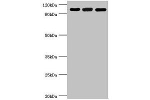 Western blot All lanes: 116 kDa U5 small nuclear ribonucleoprotein component antibody at 3 μg/mL Lane 1: Hela whole cell lysate Lane 2: 293T whole cell lysate Lane 3: NIH/3T3 whole cell lysate Secondary Goat polyclonal to rabbit IgG at 1/10000 dilution Predicted band size: 47, 44, 37 kDa Observed band size: 109 kDa (EFTUD2 Antikörper  (AA 1-205))