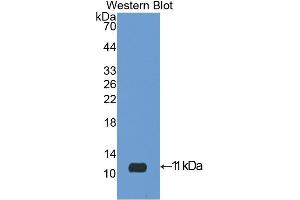 Western blot analysis of the recombinant protein. (IGF2 Antikörper  (AA 25-91))