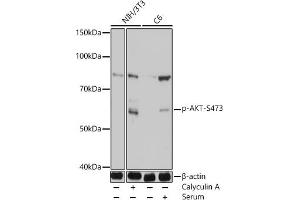 Western blot analysis of extracts of various cell lines, using Phospho-Akt-S473 antibody (ABIN7265523) at 1:1000 dilution. (AKT 1/2/3 Antikörper  (pSer472))