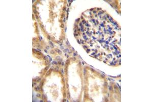DDR1 Antibody (N-term) A immunohistochemistry analysis in formalin fixed and paraffin embedded human kidney tissue followed by peroxidase conjugation of the secondary antibody and DAB staining. (DDR1 Antikörper  (N-Term))