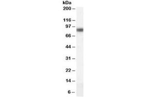 Western blot testing of human liver lysate with CPT1A antibody at 0. (CPT1A Antikörper)