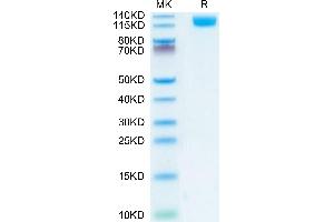 Oncostatin M Receptor Protein (OSMR) (AA 24-737) (His tag)