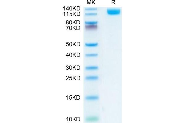 Oncostatin M Receptor Protein (OSMR) (AA 24-737) (His tag)