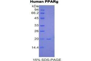 SDS-PAGE analysis of Human PPARG Protein. (PPARG Protein)