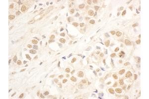 anti-NOP58 Ribonucleoprotein (NOP58) (AA 350-400) antibody