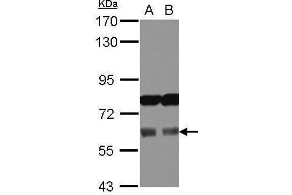 Adracalin Antikörper  (Internal Region)