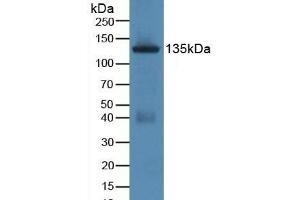 Detection of JAG1 in Rat Uterus Tissue using Polyclonal Antibody to Jagged 1 (JAG1) (JAG1 Antikörper  (AA 470-834))