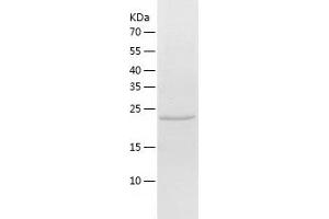 Western Blotting (WB) image for SUMO/sentrin Specific Peptidase Family Member 8 (SENP8) (AA 1-212) protein (His tag) (ABIN7288407) (SENP8 Protein (AA 1-212) (His tag))