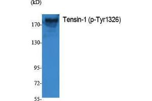 Western Blotting (WB) image for anti-Tensin 1 (TNS1) (pTyr1326) antibody (ABIN3173571) (Tensin 1 Antikörper  (pTyr1326))