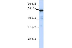WB Suggested Anti-FOXN4 Antibody Titration:  0. (FOXN4 Antikörper  (C-Term))