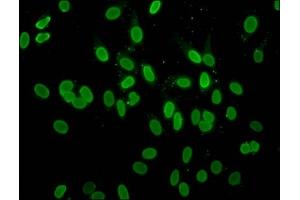 Immunofluorescence staining of Hela cells with ABIN7139181 at 1:10, counter-stained with DAPI. (H2AFZ Antikörper  (acLys4))