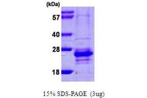 SDS-PAGE (SDS) image for Calcium Binding Protein 7 (CABP7) (AA 1-188) protein (His tag) (ABIN6386743)