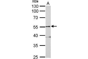 WB Image Glycine Receptor alpha 2 antibody detects GLRA2 protein by Western blot analysis. (GLRa2 Antikörper)