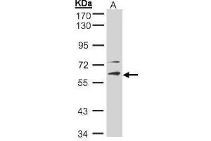 WB Image Sample(30 ug whole cell lysate) A:Hep G2 , 10% SDS PAGE antibody diluted at 1:2000 (STK33 Antikörper)