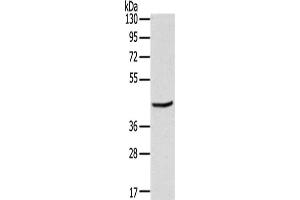 Gel: 8 % SDS-PAGE,Lysate: 40 μg,Primary antibody: ABIN7191352(MAGEB3 Antibody) at dilution 1/200 dilution,Secondary antibody: Goat anti rabbit IgG at 1/8000 dilution,Exposure time: 10 seconds (MAGEB3 Antikörper)