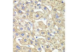 Immunohistochemistry of paraffin-embedded human liver injury using GLUD2 antibody at dilution of 1:100 (x40 lens). (GLUD2 Antikörper)