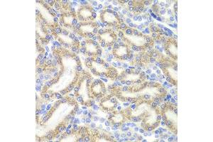 Immunohistochemistry of paraffin-embedded rat kidney using DAP antibody (ABIN5973626) at dilution of 1/200 (40x lens). (DAP Antikörper)