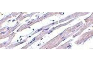 Immunohistochemistry of Apaf1 in human heart tissue with Apaf1 (NT) antibody at 1μg/ml. (APAF1 Antikörper  (N-Term))