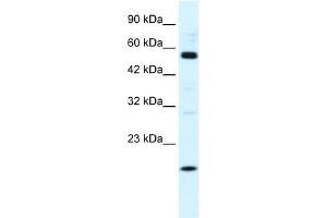WB Suggested Anti-ZNF436 Antibody Titration:  1. (ZNF436 Antikörper  (N-Term))