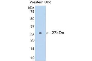 Detection of Recombinant GSTa3, Rat using Polyclonal Antibody to Glutathione S Transferase Alpha 3 (GSTa3) (GSTA3 Antikörper  (AA 1-221))