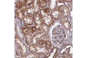 Immunohistochemical staining of human kidney with GPR113 polyclonal antibody  shows distinct cytoplasmic positivity in tubular cells at 1:50-1:200 dilution.
