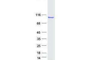 Western Blotting (WB) image for DDHD Domain Containing 2 (DDHD2) (Transcript Variant 2) protein (Myc-DYKDDDDK Tag) (ABIN2719263)