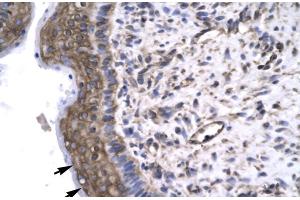 Rabbit Anti-GTF2F2 Antibody Catalog Number: ARP31437 Paraffin Embedded Tissue: Human Spermatophore Cellular Data: Epithelial cells Antibody Concentration: 4. (GTF2F2 Antikörper  (Middle Region))