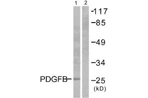 Western blot analysis of extracts from NIH/3T3 cells, using PDGFB antibody (ABIN5976488). (PDGFB Antikörper  (Internal Region))
