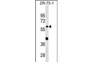 GDPD2 Antibody (Center) (ABIN1538279 and ABIN2849892) western blot analysis in ZR-75-1 cell line lysates (35 μg/lane). (GDPD2 Antikörper  (AA 305-334))