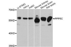 Western blot analysis of extracts of various cell lines, using PPP5C Antibody. (PP5 Antikörper)