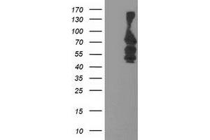 Western Blotting (WB) image for anti-Katanin P80 (WD Repeat Containing) Subunit B 1 (KATNB1) antibody (ABIN1498989) (KATNB1 Antikörper)