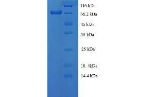 SDS-PAGE (SDS) image for Selenoprotein P (SEPP1) (AA 20-402) protein (GST tag) (ABIN5710332) (Selenoprotein P Protein (SEPP1) (AA 20-402) (GST tag))