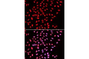 Immunofluorescence analysis of U2OS cells using B/B/SM antibody . (SMARCE1 Antikörper  (AA 1-411))