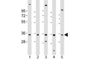 Western blot testing of human 1) HL-60, 2) K562, 3) MCF-7, 4) MOLT-4 and 5) SH-SY5Y cell lysate with PIGC antibody at 1:2000. (PIGC Antikörper  (AA 81-112))