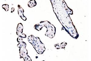 IHC analysis of splicing factor 1 using anti-splicing factor 1 antibody (ABIN7600194). (Splicing Factor 1 Antikörper  (AA 160-266))