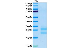 SDS-PAGE (SDS) image for Interleukin 17A (IL17A) (AA 26-158) protein (His-Avi Tag,Biotin) (ABIN7274996)