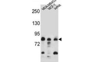 Western Blotting (WB) image for anti-AFG3-Like Protein 2 (AFG3L2) antibody (ABIN2997215) (AFG3L2 Antikörper)
