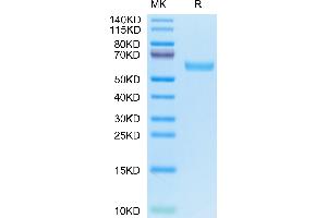 Human CD7 on Tris-Bis PAGE under reduced condition. (CD7 Protein (CD7) (AA 26-180) (Fc Tag))