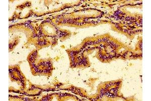 Immunohistochemistry (IHC) image for anti-Neurotensin Receptor 2 (NTSR2) (AA 359-410) antibody (ABIN7161453)