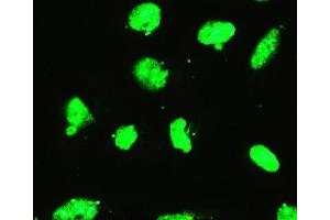 IF analysis of EWSR1 using anti-EWSR1 antibody (ABIN3043825).
