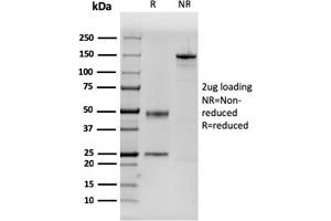 SDS-PAGE Analysis Purified Dystrophin Monospecific Mouse Monoclonal Antibody (DMD/3243). (Dystrophin Antikörper  (AA 114-263))